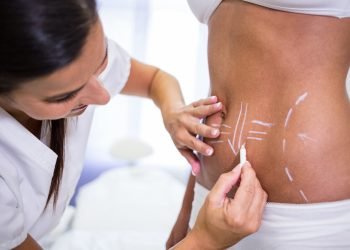 Close-up of surgeon drawing lines on womans abdomen for liposuction and cellulite removal
